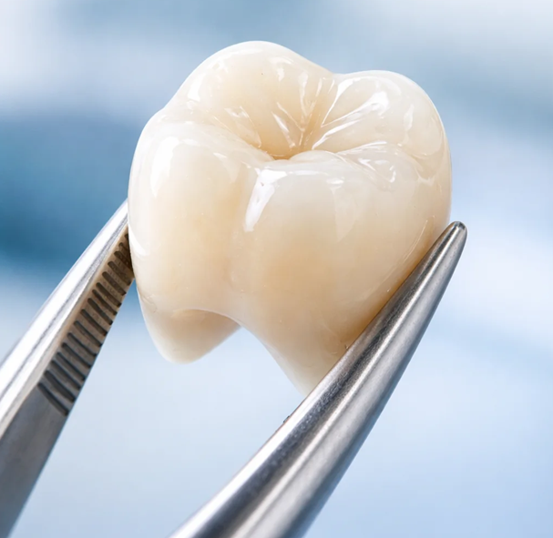 Dental crown treatment